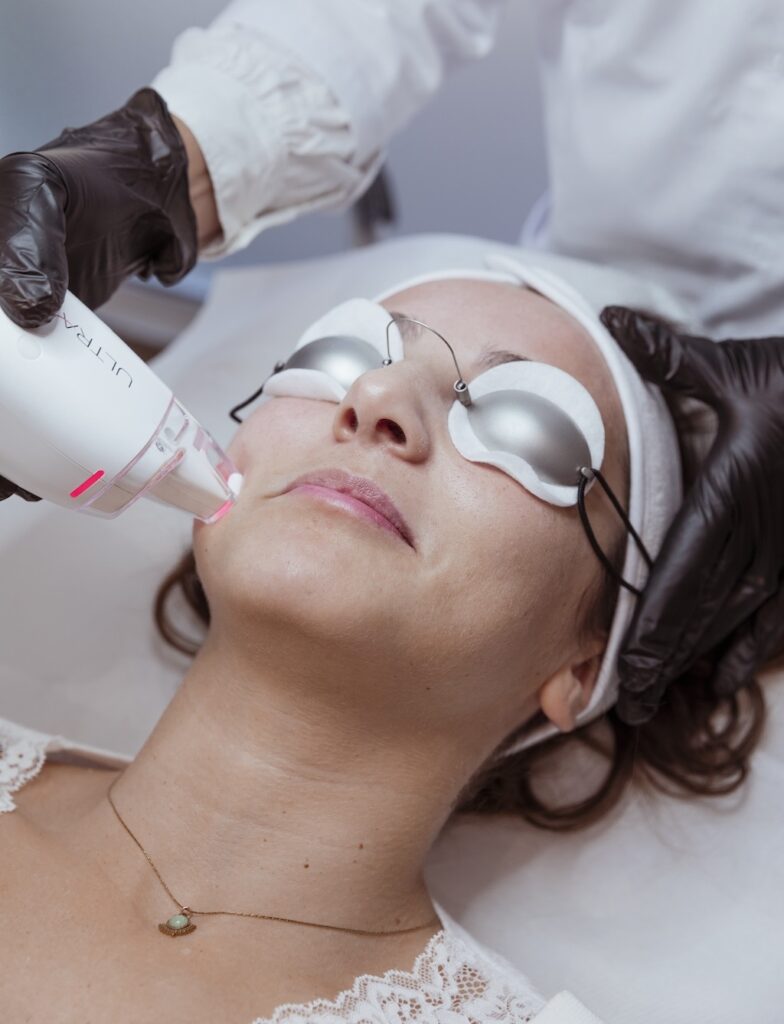 Formation esthetique et epilation laser marseille