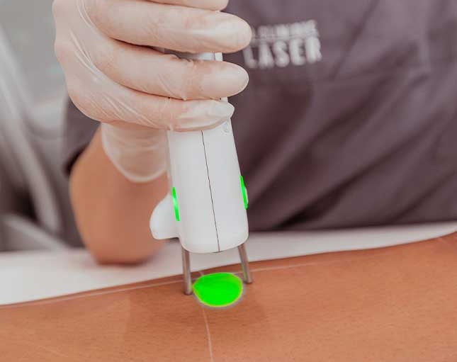 La clinique Laser, epilation laser